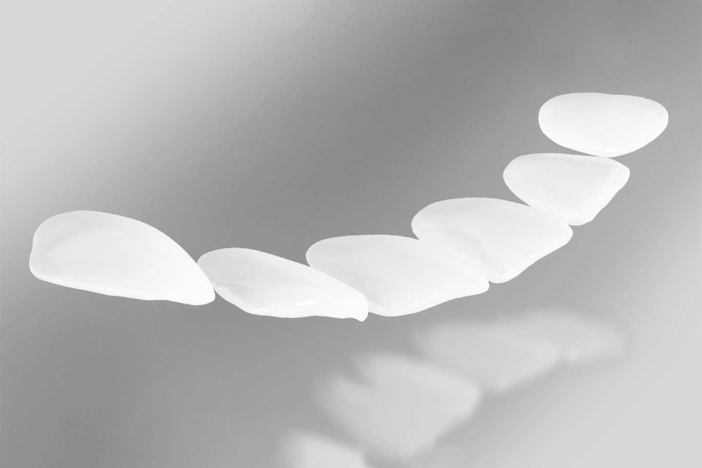 Carillas de composite